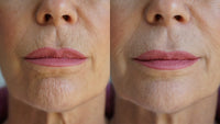 Diagram highlighting key problem areas treated by the Ageless Lip & Line Filler on face illustration.