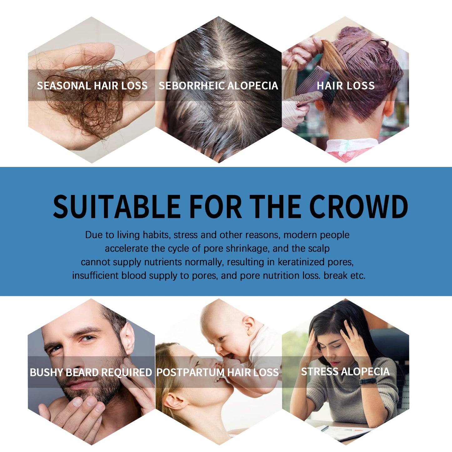 Roll Tight Hair Oil, Moisturizing Hair Care Strong, Strong And Solid Hair Repair Hairline Thick Hair Care