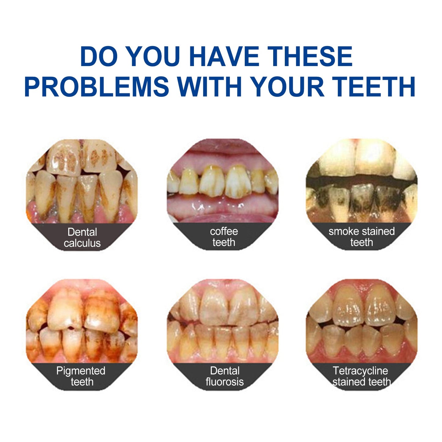 Dental pencil Teeth Cleaning Remove Dirt And Yellow Smoke Teeth Brightening Whitening Oral Cleaning Pen