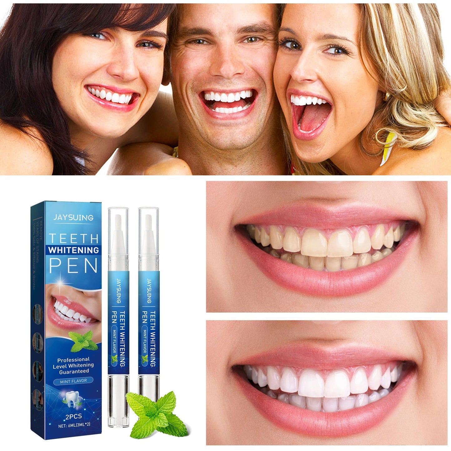 Dental pencil Teeth Cleaning Remove Dirt And Yellow Smoke Teeth Brightening Whitening Oral Cleaning Pen