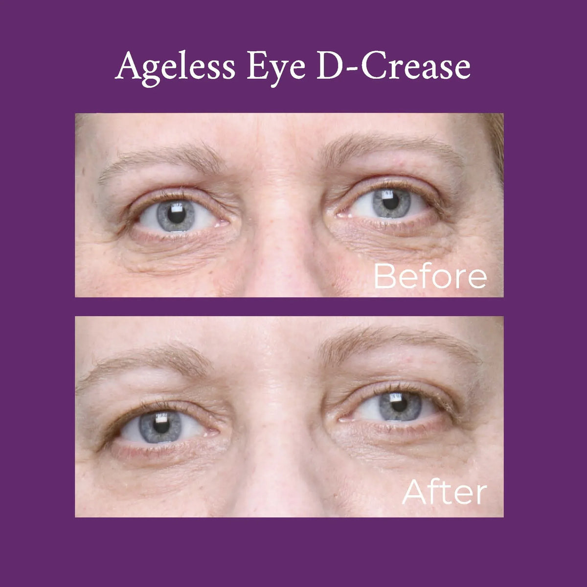 PRAI Beauty Ageless Eye D-Crease product alongside green leaves symbolizing natural ingredients