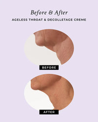 Comparison of sagging neck skin before using the anti-aging neck creme.