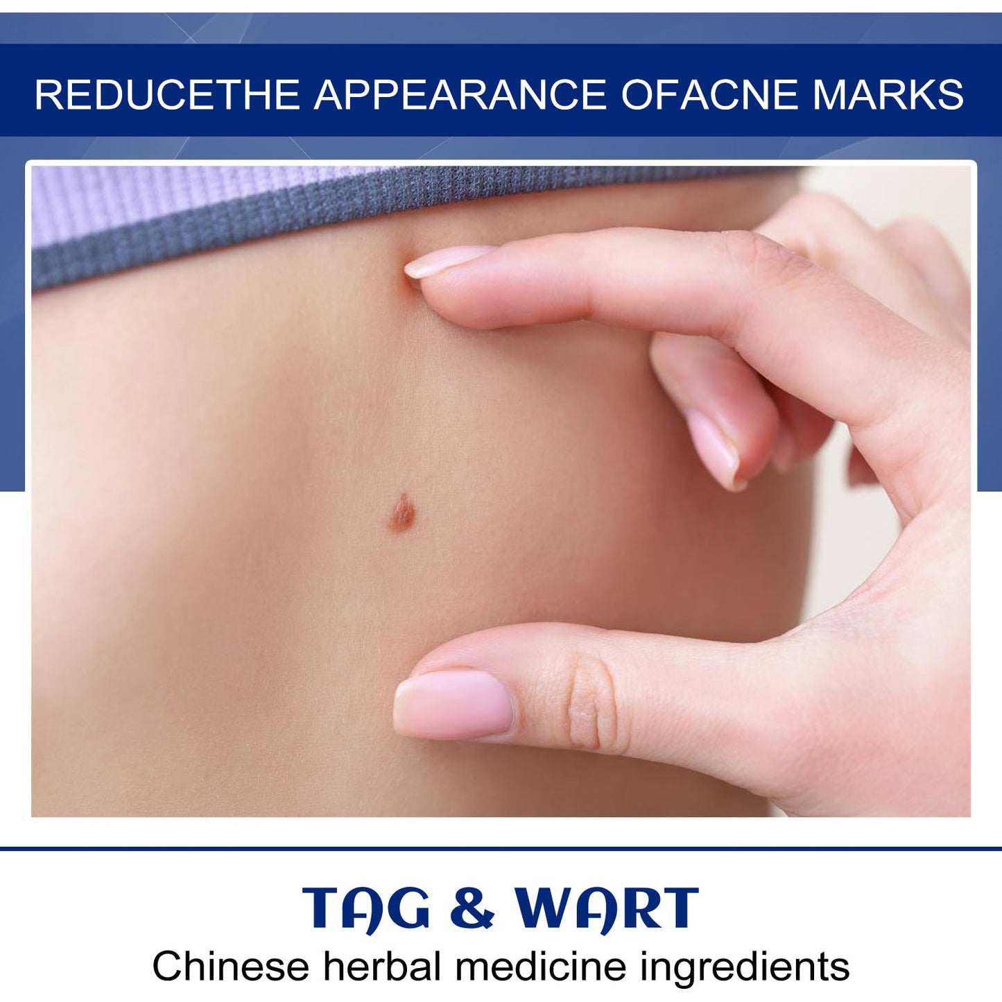 Skin Label Repair Cream Relief Mild Ingredient Skin Care Cleanses Body Skin For Extra Care