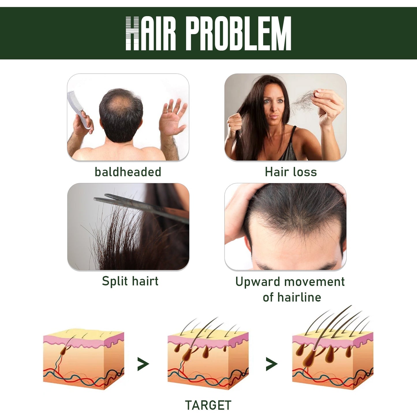 Ginger Dense Hair Spray Nourishes Hair Follicles, Prevents Hair Loss And Breaks, Moisturizes And Thickens Hair Spray