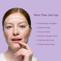 Close-up photo of smooth lips and areas around mouth demonstrating lip and line filler use.