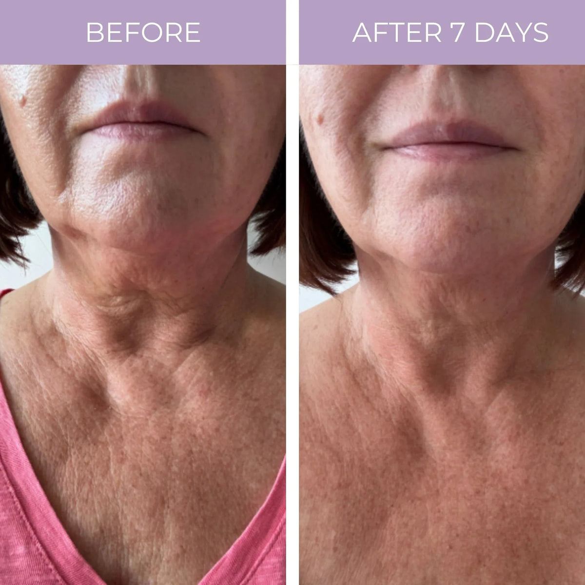 Smiling mature woman touching her neck, showcasing smooth skin.